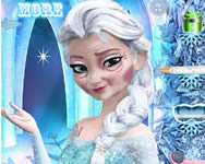 Elsa rejuvenation jegvarazs jtkok
