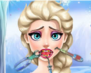 Elsa tooth injury jegvarazs jtkok